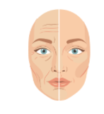 Skin rejuvenation and wrinkle improvement